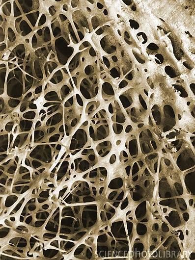 Human bone in close-up Cancellous Bone, Foto Macro, Scanning Electron Micrograph, Microscopic Photography, Microscopic Images, Natural Structures, Science Photos, Organic Form, Natural Forms