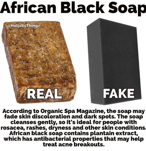 Raw African Black Soap, African Soap, Fade Skin, Perfume Versace, African Black Soap, Black Soap, Skin Discoloration, How To Treat Acne, Face Skin Care