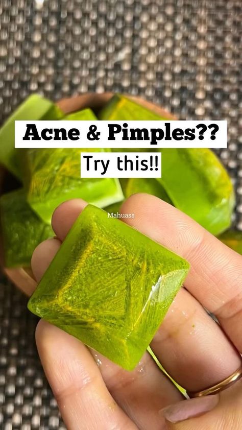 Relief from acne & pimples in 2022 | Healthy skin tips, Money life hacks, Acne and pimples Cystic Acne Remedies, Glowing Skin Secrets, Blind Pimple, Pimples Under The Skin, Forehead Acne, Pimples On Face, Pimples Remedies, Diy Acne, Natural Acne Remedies