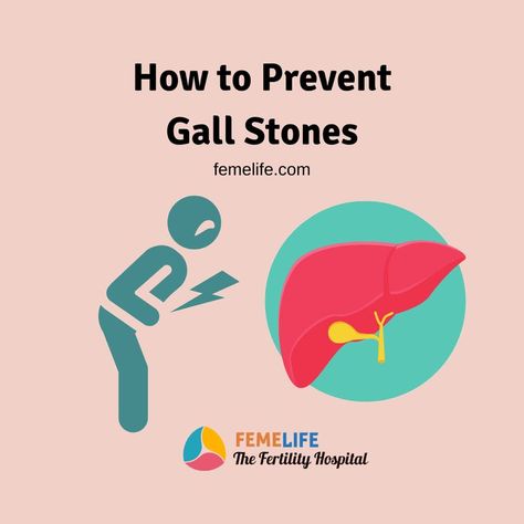 gallbladder
gallstones Bladder Stones, Western Type, Gallbladder Surgery, Gall Bladder, Food For Digestion, Bile Duct, Fiber Diet, Types Of Diets, High Fiber Diet