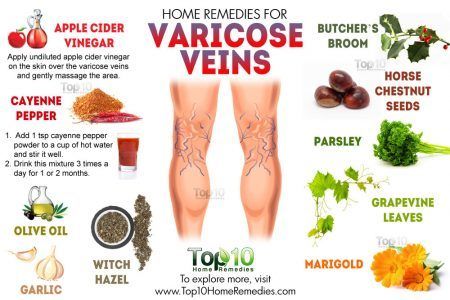 (1) New Messages! Varicose Vein Remedy, Top 10 Home Remedies, Holistic Remedies, Natural Therapy, Natural Home Remedies, Cayenne, Health Remedies, The Skin, Apple Cider