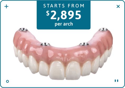 implant-2895 Permanent Dentures, Denture Adhesives, Free Dental Implants, Affordable Dentures, Denture Implants, Denture Adhesive, Dental Implant, Perfect Smile, Dentures