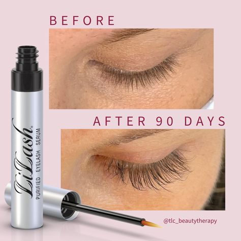 LiLash eyelash serum before and after results Uk Lash Serum, Lash Cycle, Eyebrow Slits, Eyebrow Growth Serum, Grow Lashes, Eyebrow Serum, Eyebrow Growth, Brow Serum, Eyelash Growth Serum