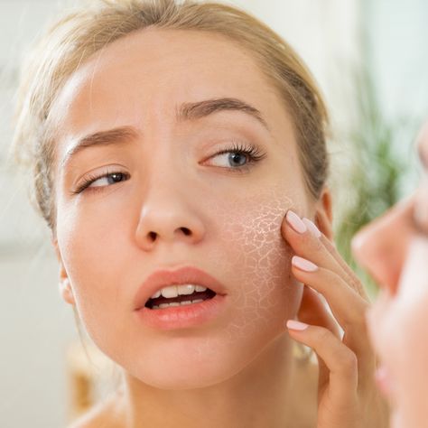 According to GH Beauty Lab Senior Chemist Sabina Wizemann, “Exfoliation is the best way to smooth skin’s surface so it reflects light and appears glowing or brightened." Exfoliate and get instant, healthy, looking skin with SilkPeel DermalInfusion (Diamond Glow Facial/Hydrofacial)! Benefits of SilkPeel DermalInfusion: 👉Gives a Lasting Youthful Boost 👉Improves Radiance; Refreshes and Revives 👉Visibly Reduces Fine Lines and Wrinkles #antiaging #southflorida #facial #silkpeel #wednesdaywisdom Kalonji Oil, Flaking Skin, Skin Dryness, Peeling Skin, Water Softener, Dehydrated Skin, 5 Ways, Skin Cells, Oily Skin