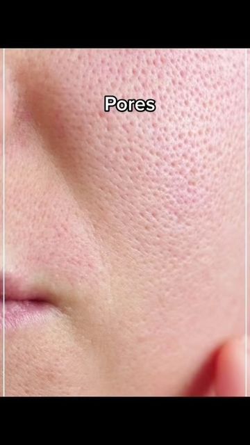 Beginner Skin Care Routine, Men Skin Care Routine, Skin Care Basics, Face Skin Care Routine, Open Pores, Diy Skin Care Routine, Serious Skin Care, Good Skin Tips, Skin Care Tutorial