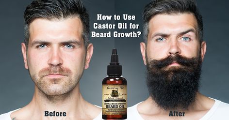 Diy Beard, Facial Hair Growth, Accelerate Hair Growth, Hair Growth For Men, Castor Oil For Hair Growth, Thick Beard, Beard Growth Oil, Face Routine, Growth Hair