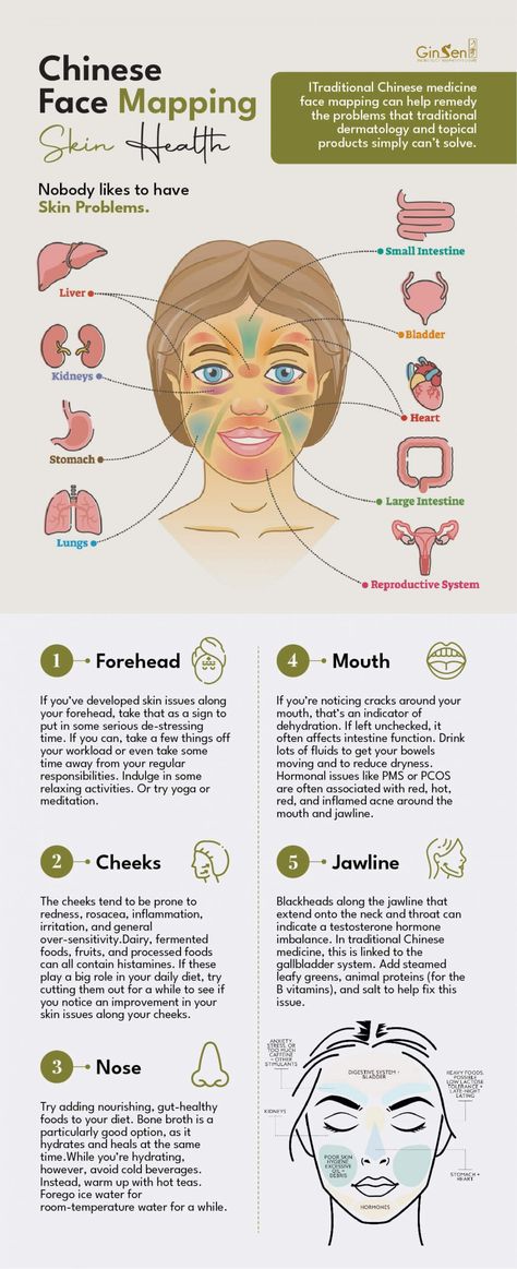 Improve Your Skin Health with Chinese Face Mapping | Mien Shiang Chinese Facial Mapping, Chinese Face Mapping Acne, Acne Chart Face Mapping, Face Mapping Health, Chinese Medicine Face Map, Face Health Chart, Acne Map, Facial Mapping, Chinese Face Map