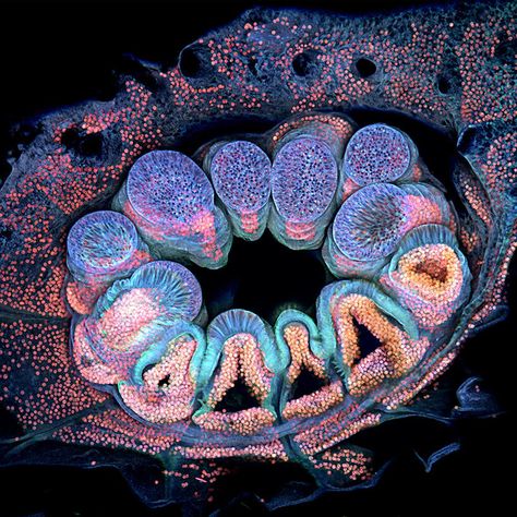 Long Leg Spider, Human Tongue, Nikon Small World, Microscopic Organisms, Micro Photography, Microscopic Images, Slime Mould, Dinosaur Bones, World Photo