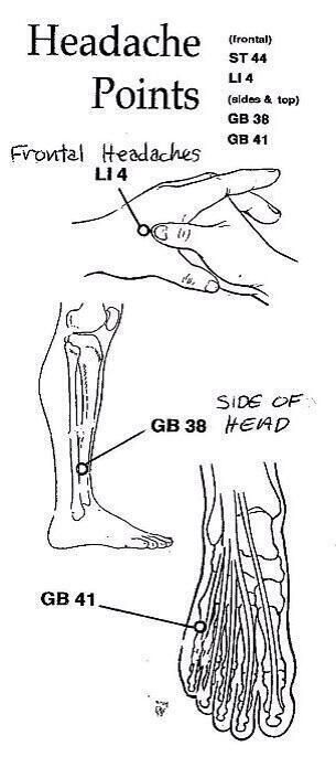 Tension Headache, Headache Relief, Acupressure Points, Trigger Points, Pressure Points, Reflexology, Health Info, Acupressure, Alternative Medicine