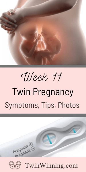 5 Weeks Pregnant Belly, 5 Weeks Pregnant Ultrasound, Week 5 Pregnancy, Twin Ultrasound, Twin Pregnancy Symptoms, Twins Ultrasound, Twin Belly, Twin Pregnancy Belly, Twin Parenting