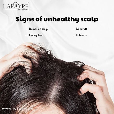 Signs of Unhealthy Scalp Natural Luxury, Greasy Hair Hairstyles, Scalp Care, Hair Care Routine, Dandruff, Hair Care Tips, Clean Beauty, Ayurveda, Beauty Care