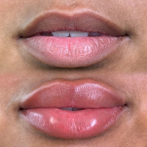 . . . . . . . . . . #lips #lipblushing #pmuartist #raleighnc #raleighlipblush #cosmetictattoo #naturalpmu #neutralization #ncbrows #microbladingraleigh #raleighlipfiller #lipstick #lipcolor Lip Blushing Brown Skin, Lip Injections Black Women, Lip Fillers On Black Women, Lip Blush Aesthetic, Lip Neutralization Before And After, Lip Blushing Black Women, Lip Filler Before And After Black Women, Lip Color For Olive Skin, Lip Filler Black Women