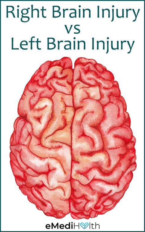 Brain Bleed Recovery, L Tyrosine Benefits, My Beautiful Broken Brain, Vitamin Sources, Concentration Exercises, Brain Recovery, Brain Surgery Recovery, Injury Quotes, Brain Issues