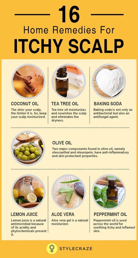 Remedies For Itchy Scalp, Dry Scalp Remedy, Natural Aloe Vera Gel, Dry Itchy Scalp, Natural Aloe Vera, Natural Healing Remedies, Itchy Scalp, Natural Therapy, Hair Treatments