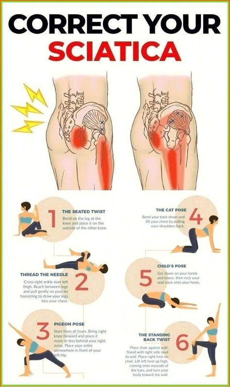 https://pin.it/5YOFYMDFz Sciatic Nerve Pain Relief, Sciatica Stretches, Bolesti Chrbta, Sciatica Exercises, Sciatica Pain Relief, Sciatica Relief, Back Stretches For Pain, Lower Back Pain Exercises, Latihan Yoga