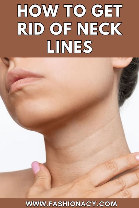 How To Get Rid of Neck Lines Neck Wrinkles Remedies, Natural Wrinkle Remedies, Home Remedies For Wrinkles, Blind Pimple, Prevent Pimples, Neck Lines, Dermatologist Recommended Skincare, Skin Wrinkles, Wrinkle Remedies