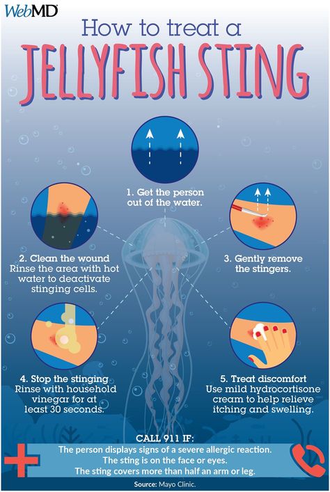 Jellyfish stings First Aid Steps, Jellyfish Quotes, Types Of Jellyfish, Jellyfish Facts, Jellyfish Sting, Jellyfish Lantern, Jellyfish Jewelry, Jellyfish Costume, Jellyfish Illustration