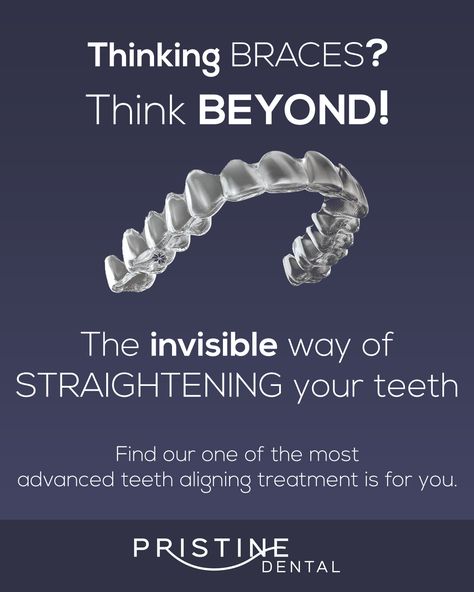 Aligners For Teeth, Dental Aligners, Invisible Aligners, Dental Social Media, Dental Images, Teeth Alignment, Dental Posters, Digital Marketing Design, Birthday Party Theme Decorations