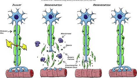 Figure 1 from Peripheral nerve regeneration: experimental strategies and future perspectives. | Semantic Scholar Peripheral Nerve Injury, Tissue Engineering, Peripheral Nervous System, Peripheral Nerve, Medical Pictures, Platelet Rich Plasma, Adrenal Glands, Medicine Journal, Regenerative Medicine