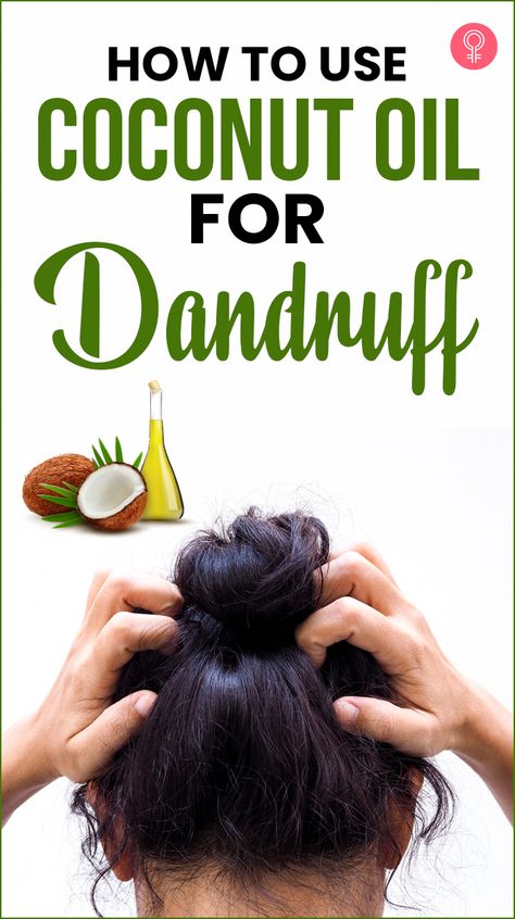 Wondering how to use coconut oil for dandruff? If yes, then you are on the right page. Read on to know more about coconut oil, its benefits, and how to use it. Coconut Oil For Dandruff, Coconut Oil Remedies, Natural Dandruff Remedy, Hair Mask For Dandruff, Coconut Oil Mask, Oils For Dandruff, Coconut Oil Shampoo, Dandruff Remedy, Diy Coconut Oil