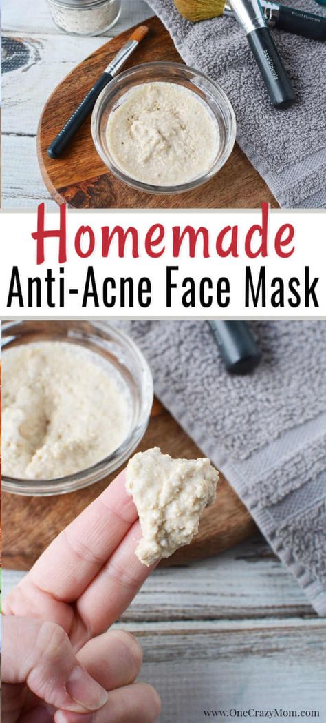 Do you struggle with acne but want an all natural product to use? We have an easy DIY Face Mask for Acne that will improve the appearance of your skin. #onecrazymom #acne #acnetreatment #acnetips #acnescars #acnescartreatment #facemask #diyfacemask #homemadefacemask Homemade Face Mask For Acne, Diy Face Mask For Acne, Acne Face Mask Recipe, Anti Acne Face Mask, Face Mask For Acne, Baking Soda Face Mask, Mask For Acne, Face Mapping Acne, Banana Face Mask