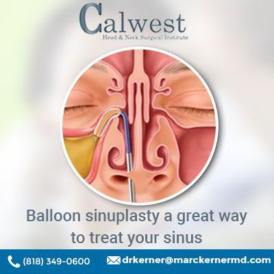 Balloon sinuplasty a great way to treat your sinus Yellow Mucus, Acute Sinusitis, Blocked Sinuses, Paranasal Sinuses, Chronic Sinusitis, Facial Surgery, Sinus Problems, General Anaesthesia, Allergic Rhinitis