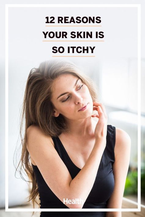 Here, Find out what's causing your constant urge to scratch so you can figure out how to treat it. #skincare #healthandwellness Itchy Skin Causes, Itchy Face, Itchy Rash, Scaly Skin, Top Skin Care Products, Itchy Skin, Skin Tips, Anti Aging Skin Products, Improve Health