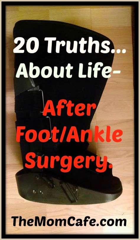 20 Truths about Life after Foot Ankle Surgery Fractured Ankle Recovery, Lisfranc Surgery Recovery, Trimalleolar Fracture Recovery, Ankle Surgery Recovery Tips, Trimalleolar Fracture, Ankle Fracture Recovery, Torn Ligament In Ankle, Fractured Ankle, Ankle Surgery Recovery