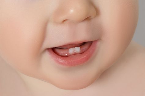 Teething Symptoms, Kat Diy, Discolored Teeth, Implant Dentistry, Family Dentist, Pediatric Dentistry, Do Baby, Natural Teeth Whitening, Best Dentist