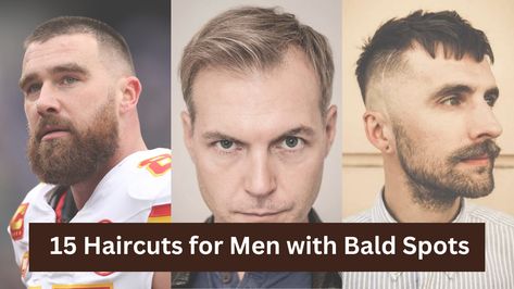 Experiencing hair loss or bald spots can be a depressing and challenging phase for many men. Whether it's a receding hairline, a thinning crown or a full bald spot, finding the right hairstyle can make all the difference in maintaining a confident and self esteemed personality. Bald spots are a common concern for many men, and finding the right haircut is more concerning for some. Mems Haircut, Haircuts For Balding Men, Short Quiff, Best Haircuts For Men, Best Haircuts, Receding Hairline, Bald Spot, Bald Men, Many Men