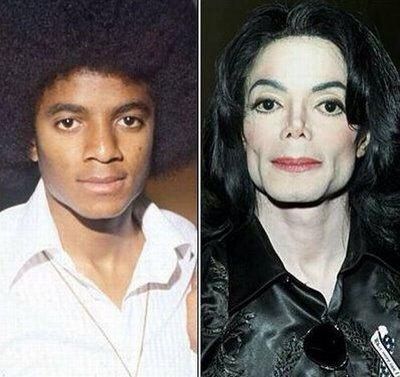 Michael Jacksons transformation Bad Plastic Surgeries, Career Girl Daily, Plastic Surgery Gone Wrong, Celebrity Plastic Surgery, Celebrities Then And Now, Joseph Jackson, The Jacksons, Now And Forever, Cosmetic Surgery