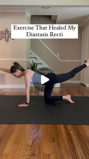 Ab Workouts Diastasis Recti, Diastasis Recti Exercises At Home, Diastasis Recti Exercises Workout, Repair Diastasis Recti, Exercises For Recti Diastasis, Ab Exercises For Diastasis Recti, Lower Diastasis Recti Exercises, Prevent Diastasis Recti During Pregnancy, How To Fix Diastasis Recti