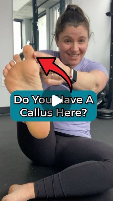 Gait Happens on Instagram: "👋 Dr. Riley here again! Calluses can be a really helpful way to identify areas of increased friction or force through the foot. While we can see a callus develop anywhere, there are few most common spots that they pop up, one being the inner part of the big toe.   🦶This spot, termed a ‘pinch callus’, is usually indicative that the person is rolling around their big toe, rather than pushing through it. Why that is happening can vary and requires further assessment, but it’s typically a lack of mobility somewhere in the foot or up the chain, or decreased strength and control of the muscles that help to control rotation in the foot and leg.   ‼️I see a pinch callus as an OPPORTUNITY! It’s get me thinking, ‘hey there is something going on here that we likely impro How To Remove Calluses From Foot, Calloused Feet Remedy, How To Get Rid Of Calluses On Feet Fast, Calluses On Feet Remedies, Callus Remover Diy, Get Rid Of Corns, Toe Exercises, Best Callus Remover, Shoulder Impingement