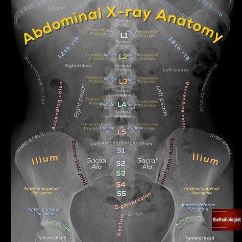 Pinterest || A.J Radiography Student, Medical Radiography, Radiology Student, Radiology Technician, Radiology Imaging, Radiology Tech, Medical Student Study, Nursing School Survival, Nursing School Tips