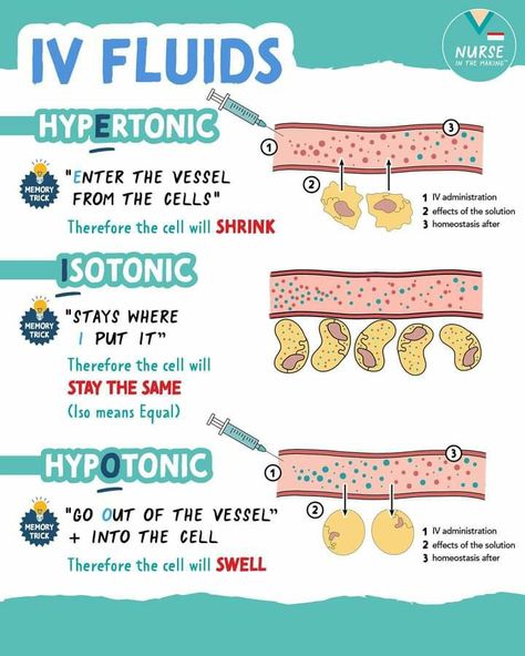 Normal Saline Vs Lactated Ringers, Nursing Preceptor Tips, Iv Therapy Nursing Notes, Nurse Preceptor Tips, Nursing School Neumonics, Vtne Study Notes, Nursing Instructor Tips, Fluids And Electrolytes Nursing, Iv Fluids Nursing