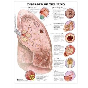 Lung Anatomy, Nursing Information, Anatomy Poster, Body Diagram, Pulmonology, Respiratory Care, Respiratory Therapy, Nursing School Notes, Medical Anatomy