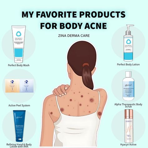 🌟 MY FAVORITE PRODUCTS FOR BODY ACNE 🌟 I want to share some amazing products that can help you with body acne. These products are super easy to use and have worked wonders for our clients 🩵Perfect Body Wash: This body wash is gentle and effective. It helps clear up acne, leaving your skin feeling fresh and clean. If you have KP you absolutely need this!!! 🩵Perfect Body Lotion: Say goodbye to body acne with this lightweight lotion. It controls oil, prevents breakouts, and gives you smoothe... Body Lotions, Body Care, Clear Up Acne, Acne Lotion, Body Acne, Favorite Products, Perfect Body, Amazing Products, Body Wash