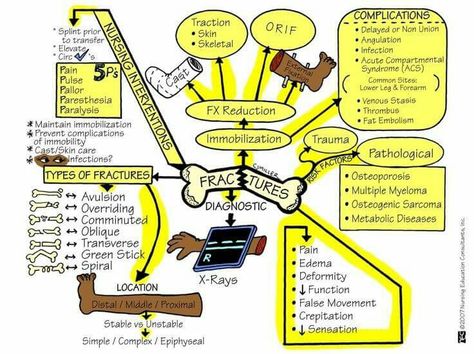 Types of fractures, complications, nursing interventions                                                                                                                                                                                 More School Tips And Tricks, Orthopedic Nursing, Osteogenesis Imperfecta, Nursing Cheat, Nursing Fun, Med Surg Nursing, Nursing Study Guide, Nursing Mnemonics, Surgical Nursing