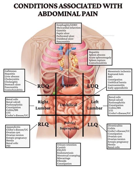 Stephanee Beggs, RN, BSN on Instagram: “WHAT’S CAUSING YOUR ABDOMINAL PAIN? I’m dropping some veryyy important conditions related to each quadrant of the abdomen!!! “Why do I…” Abdominal Quadrants And Organs, Gastrointestinal Nursing, Body Knowledge, Medicine School, Quadrants Of The Abdomen, Anatomy Organs, Study Goals, Basic Anatomy, Nursing 101