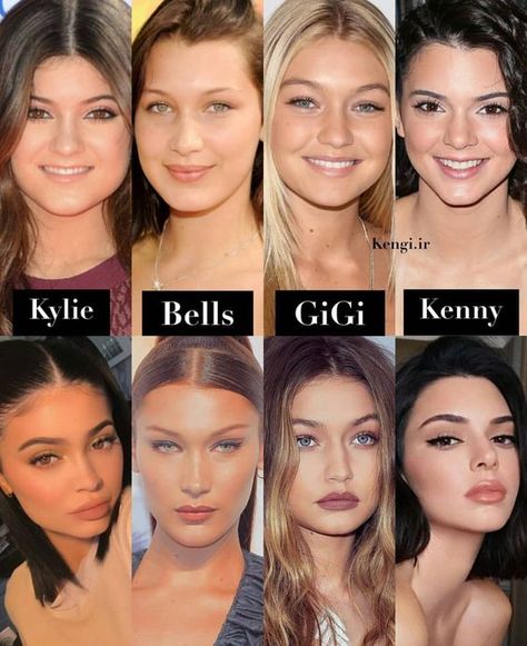 Kylie Jenner Plastic Surgery, Rhinoplasty Nose Jobs, Celebs Without Makeup, Celebrity Plastic Surgery, Celebrities Before And After, Lipstick Art, Perfect Lips, Nose Job, Cosmetic Procedures