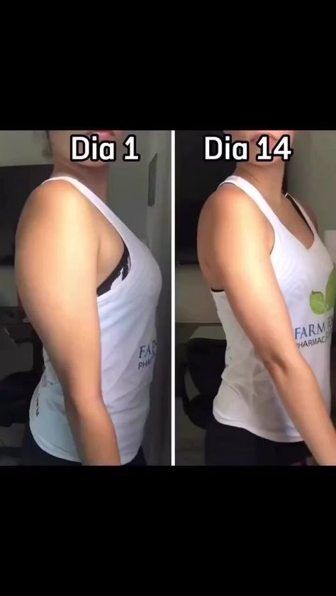 Getting there ... Hehhehe #fbreels #fbreelsvideo #weightlossjourney #momexercise #athomeworkouts #beautifulmonster #meletmelet #simpleexercise #burning #armexercises #letsdoittogether #hotmom | Analyn Diez Abarte | Analyn Diez Abarte · Original audio Skin Exercise, Reduce Arm Fat Exercise, Arm Fat Exercises, Reduce Arm Fat, Lose Arm Fat, Arm Fat, Trening Fitness, Bodyweight Workout Beginner, Weight Workout Plan