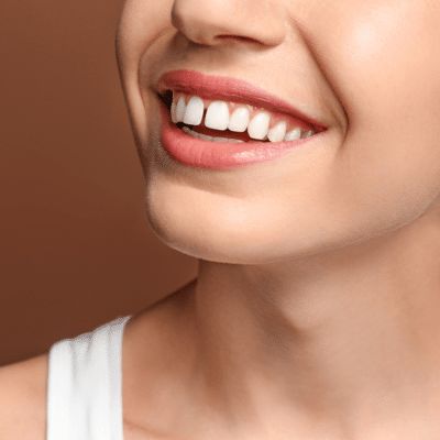 Gaps between teeth, also known as diastemas, can affect more than just the appearance of your smile. At Tomblyn Family Orthodontics, we understand that whether it's a small gap between your front teeth or larger spaces Gap Between Teeth, Traditional Braces, Crooked Teeth, Gap Teeth, Front Teeth, Clear Aligners, Teeth Braces, Metal Braces, Bone Loss