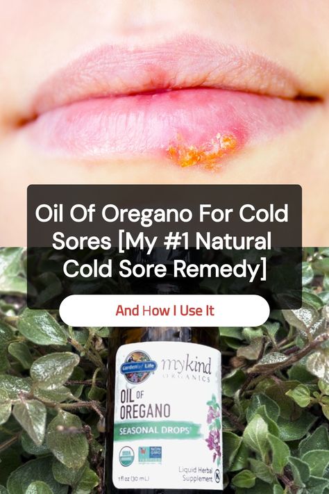 Save this pin to learn how I use oil of oregano for cold sores. If you’re looking for a natural cold sore remedy that packs a punch, this might become one of your favorites, too. Essential Oil For Cold Sore On Lip, Diy Cold Sore Remedy Fast, Cold Sore Remedy Fast, Heal Cold Sores Fast, Cold Sore Remedy Overnight, Essential Oils For Cold Sores, Cold Sore Remedy, Cold Sore Essential Oil, Natural Cold Sore Remedy