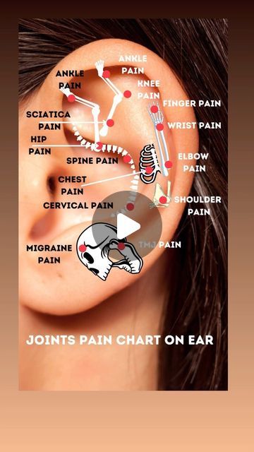 Dr. Aadil Khan on Instagram: "Ear acupuncture points have been widely known to relieve the pain associated with this physical issue. Acupuncture points on the ears may help relieve pain and tension around the body. Activating pressure points in the ear may help ease symptoms of several conditions.  #ear #auricular #acupuncture #acupressure #health #pain #organschart #organspoint #jointpain #ankle #shoulder #migraine #tmj #chest #wrist #ankle #knee #sciatica #cervical #acupuncturistaadilkhan   Disclaimer: This content is for educational purposes only and is not a substitute for professional medical advice. Please consult a doctor for any health concerns.  Disclaimer: Reposting this content without permission is prohibited. Please contact us for authorization." Ear Acupuncture Points, Ear Acupressure Points, Auricular Acupuncture, Body Pressure Points, Painful Pimple, Ear Seeds, Ear Acupuncture, Itchy Ears, Acupuncture Benefits