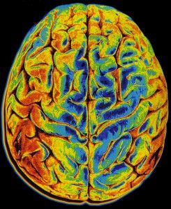 How Does Neuroplasticity Work? Jon Lieff, M.D. Brain Painting, Brain Scan, Brain Art, The Human Brain, Brain Science, Body Scanning, Daft Punk, Human Brain, Neurology