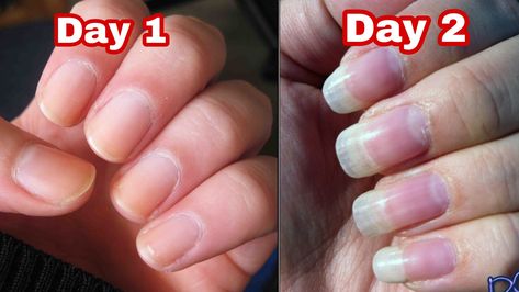 Fast Nail Growth, Grow Nails Fast, Grow Your Nails Faster, Nail Growth Faster, Nail Growth Tips, Grow Nails Faster, Fast Nail, How To Grow Nails, Nail Growth