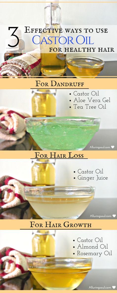 Castor Oil Hair Mask is great for all your hair woes as it has all the essential nutrients which promote hair growth and treat dandruff and also prevents from hair fall. To get the fabulous benefits of castor oil, all your need is to follow these recipes. Oil For Healthy Hair, Castor Oil Hair Mask, Benefits Of Castor Oil, Treat Dandruff, Castor Oil Hair, Oil Hair Mask, Castor Oil For Hair Growth, Castor Oil Benefits, Promote Hair Growth