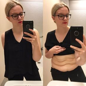 17 Women Share Pics of Loose Skin After Weight Loss to Prove How Common and Normal It Is | SELF Body Positive, Natural Skin Tightening, Skin Tightening Face, Tighten Loose Skin, Excess Skin, Saggy Skin, Loose Skin, Daily Habits, Skin Tightening