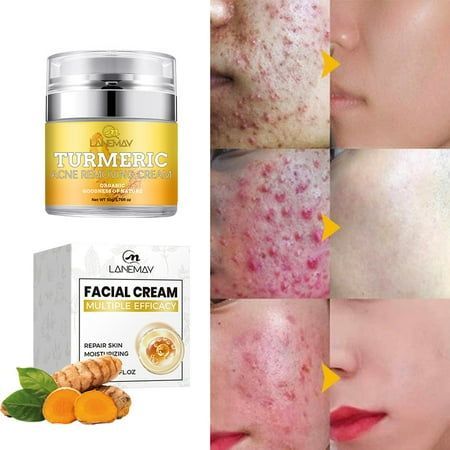 Turmeric Cream, Turmeric Facial, Turmeric Face, Cream For Face, Skin Aesthetics, Skin Care Benefits, Skin Care Collection, Skin Detox, Turmeric Powder