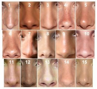 Different nose shapes, can be used as a reference in drawing a face. Types Of Nose, Different Nose Shapes, Body References, 얼굴 드로잉, Výtvarné Reference, Nose Drawing, Face Drawing Reference, Nose Shapes, Human Reference